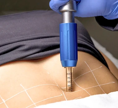 Pressurized Mesotherapy